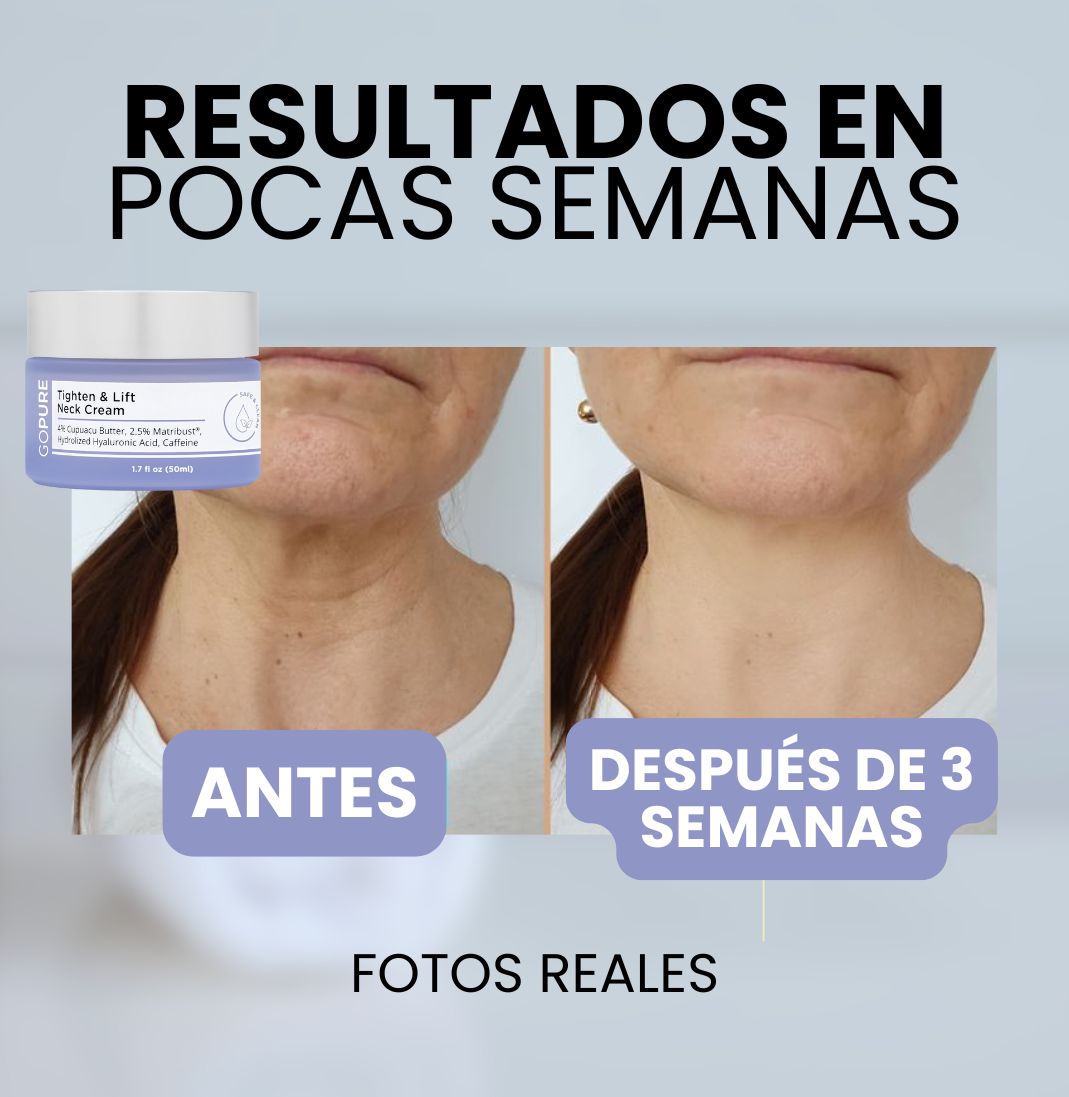 GOPURE LIFTING - CREAMA REAFIRMANTE - Formula Avanzada