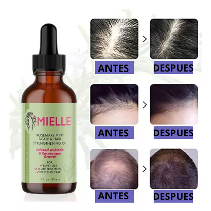 2x1 SERUM MIELLE PREMIUM™ - SUERO ANTI-CAÍDA DEL CABELLO, Formula Herbal Avanzada